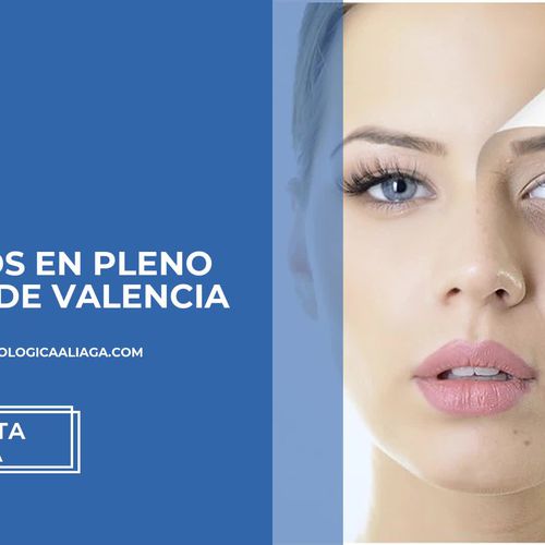 Tratamiento de hiperhidrosis axilar en Valencia: Aliaga Clínica Dermatológica