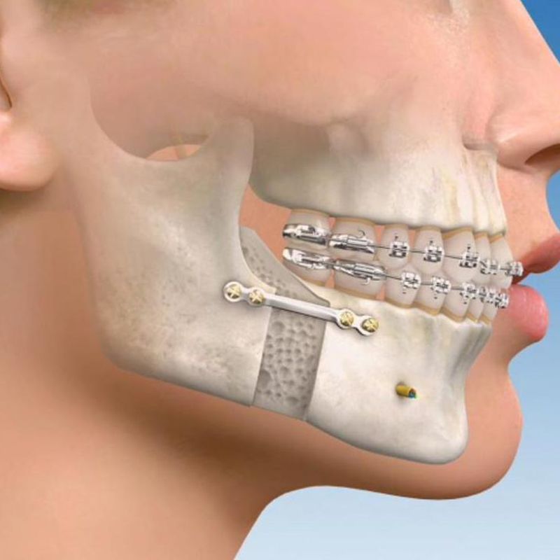 Cirugía maxilofacial: Aiara Centro Dental de Aiara Centro Dental