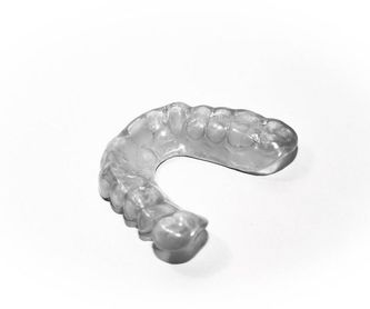 Implantes dentales: Servicios de Vila Dental Dra. Sonia Molina