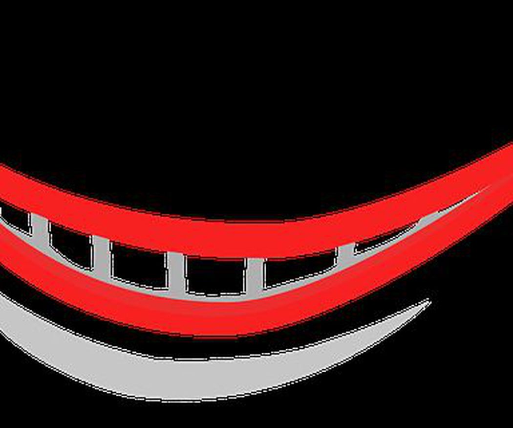 ¿Qué es un implante dental? ¿Cómo se sujeta?