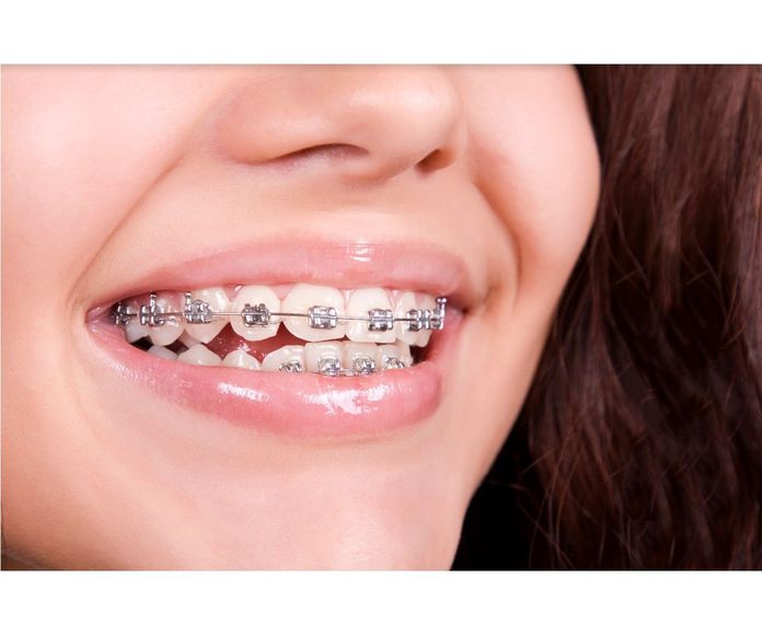 Ortodoncia: Tratamientos dentales de Centro Dental Sant Fost
