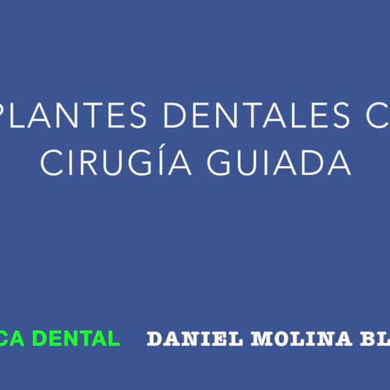 Implantes dentales: Tratamientos y tecnología de Clínica Dental Daniel Molina