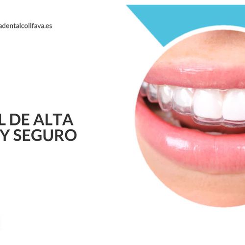 Clínica dental Sant Cugat del Vallès | Clínica Dental Coll Favà