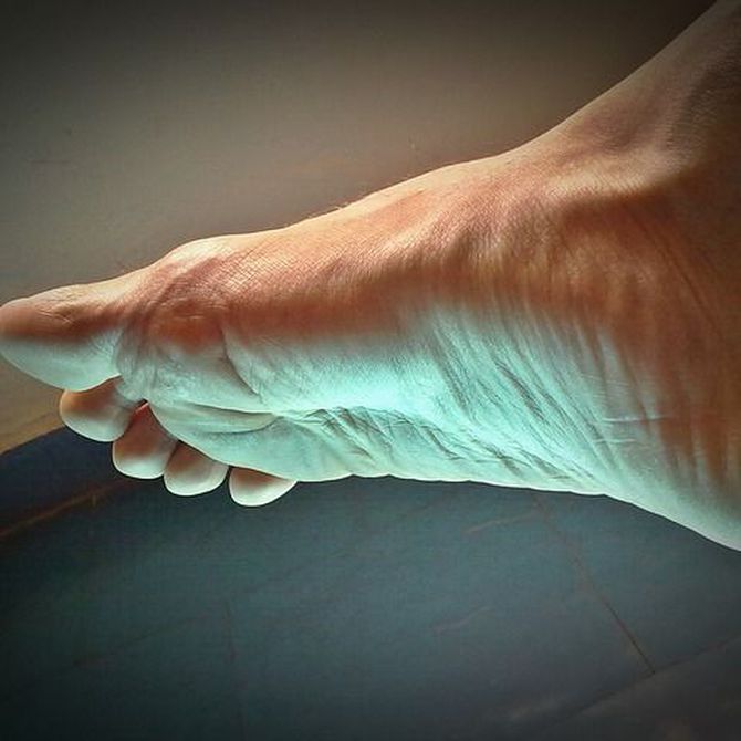 Problemas y lesiones más habituales en los pies