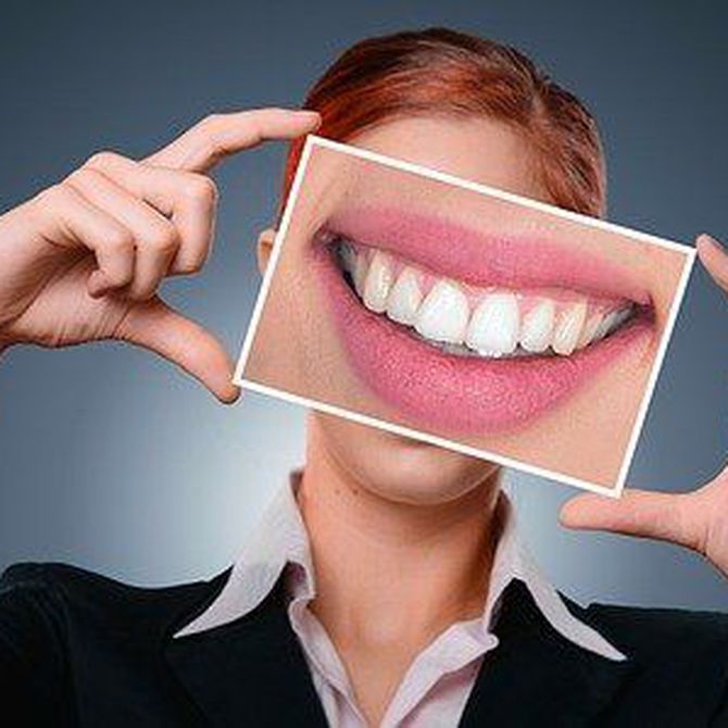 Ventajas del blanqueamiento dental
