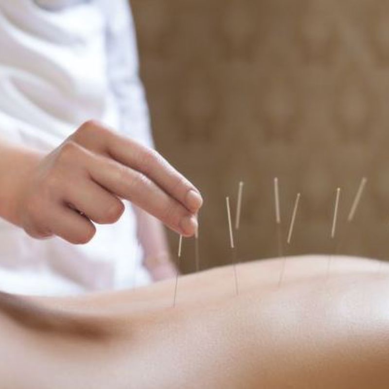 Acupuntura: Terapias de Saüc Salut