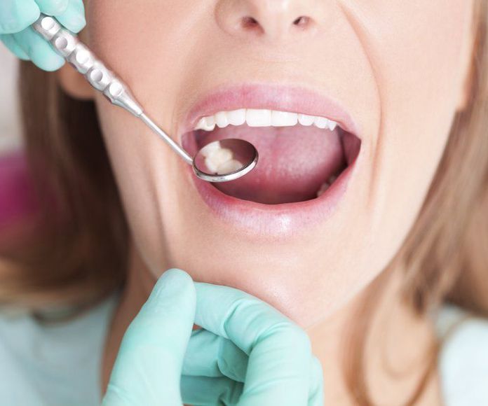 Periodoncia: NUESTROS TRATAMIENTOS de Clínica Dental Annie Duran