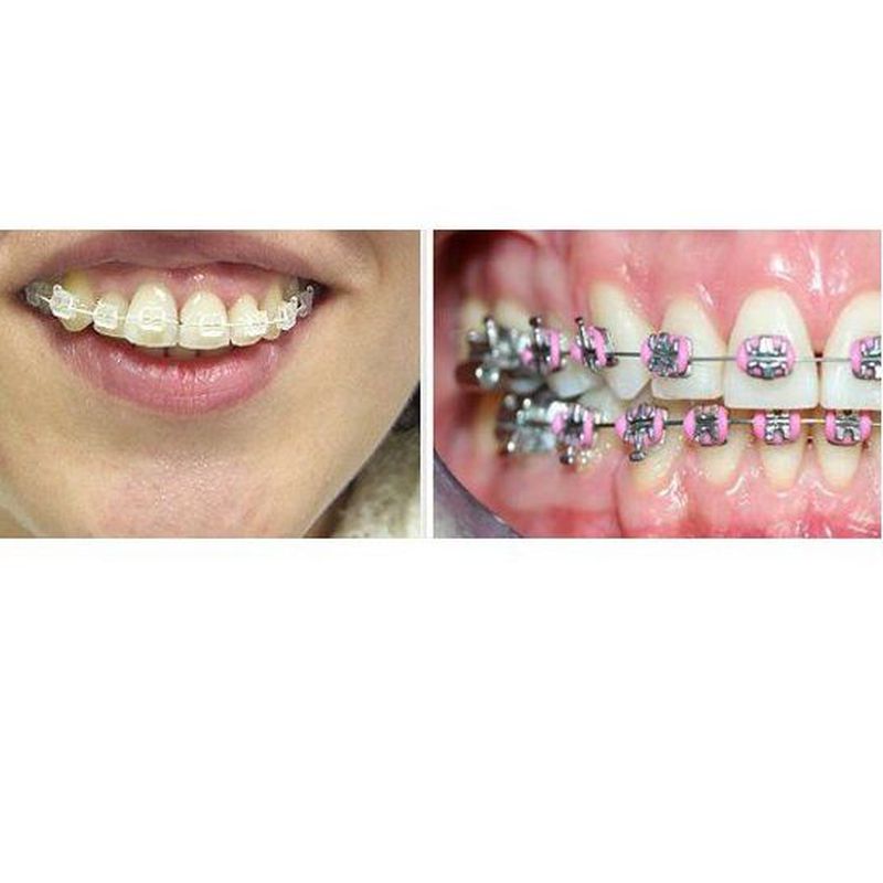 Ortodoncia: Especialidades de Clínica Dental Dres. Carrasco y García