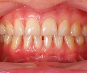 Periodoncia - Dra. Granados