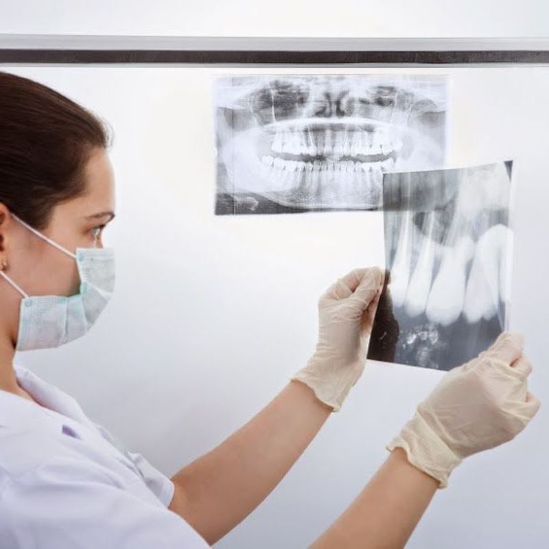 Odontología general e integral: Servicios de Clínica Sasermed Dental Buhaira