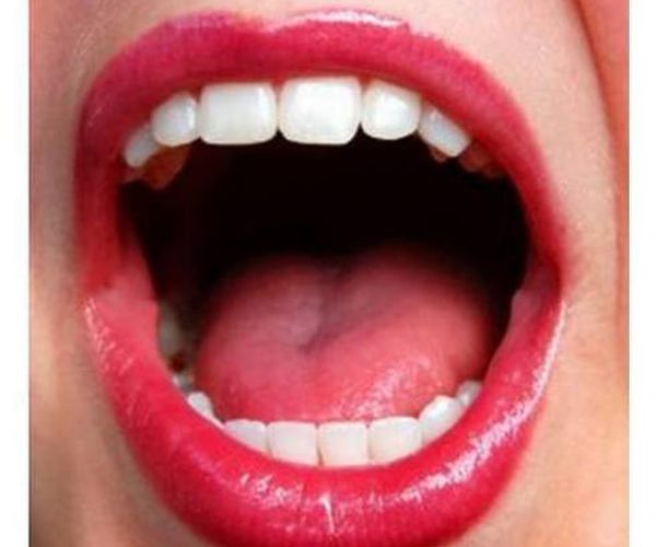 Limpieza dental