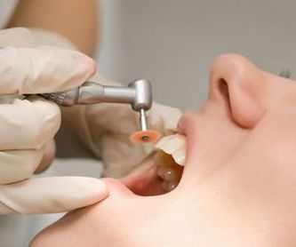 Cirugía bucal: Servicios de Clínica Especialidades Dentales