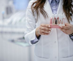 Implantes dentales: Solución definitiva para la salud bucal y el bienestar general