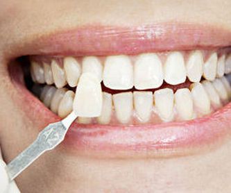 Prótesis dental: Tratamientos de Clínica Dental Avenida