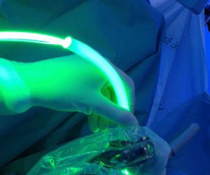 Tratamientos quirúrgicos con láser verde