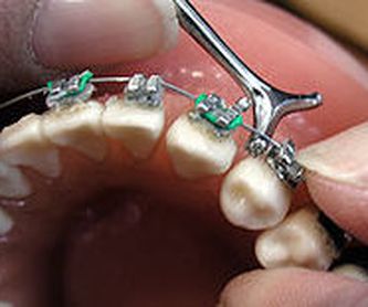 Protesis: Tratamientos dentales de Clínica Dental Dres. Nuñez García