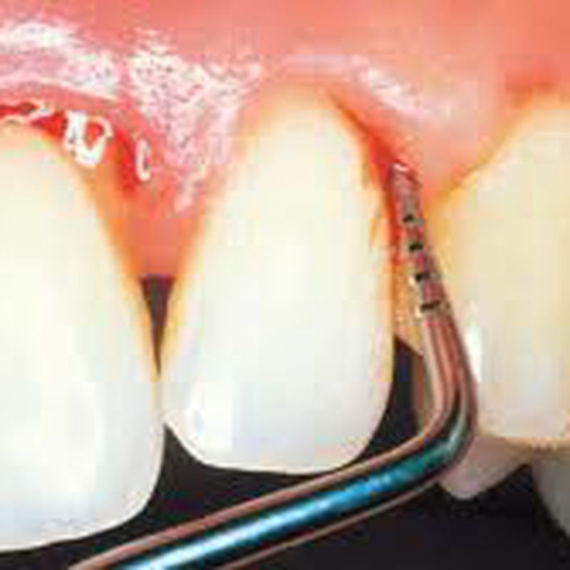 Periodoncia: Tratamientos de Dental Icaria, S.L.
