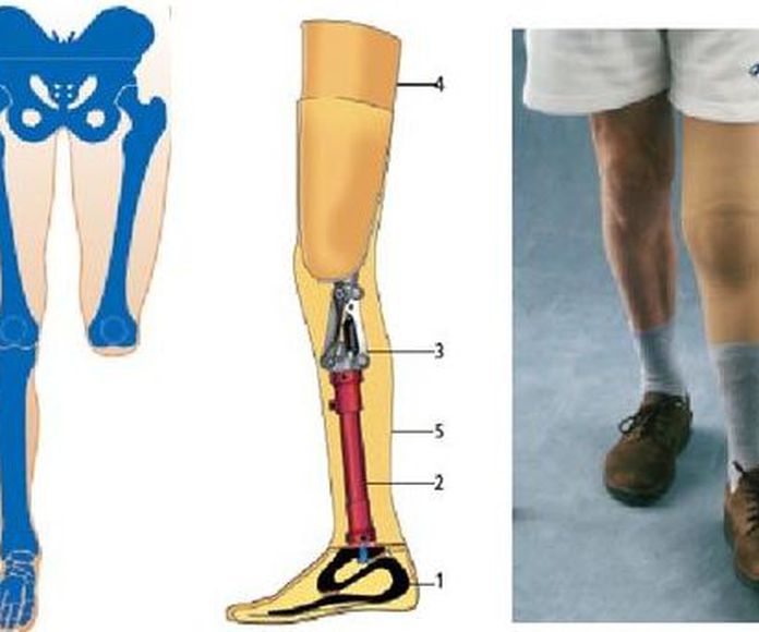 Prótesis de pierna: Productos y servicios de Ortopedia Delgado, S. L. }}