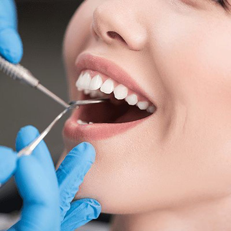 Periodoncia: Servicios de Clínica Sasermed Dental Buhaira
