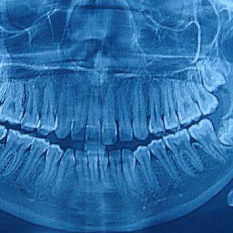 Radiología: Catálogo de Clínica Dental Cuesta y Ruisánchez, S.L.