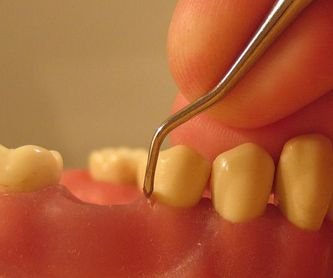 Implantología: Especialidades de Clínica Dental Virgen de la Victoria. Dr. Leopoldo Hernández