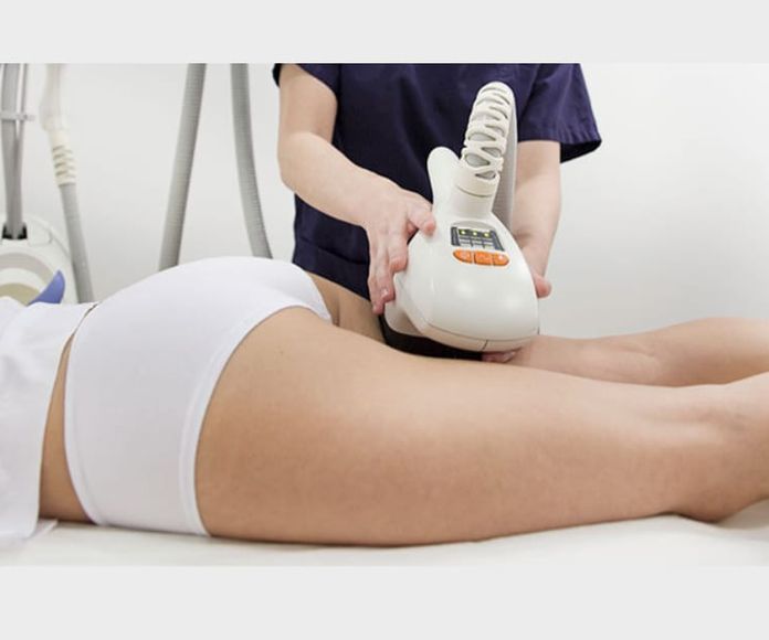 Vela Smooth -Tratamiento Corporal: Servicios de Nefertiti Estética Avanzada
