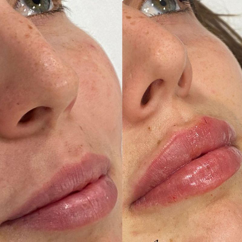 Tratamientos médicos: Tratamientos de estética de Clínica Estética Loveliness