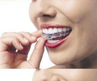 Bracketts: Tratamientos dentales de Clínica Dental Dres. Nuñez García