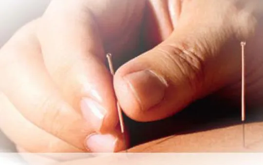 Acupuntura
