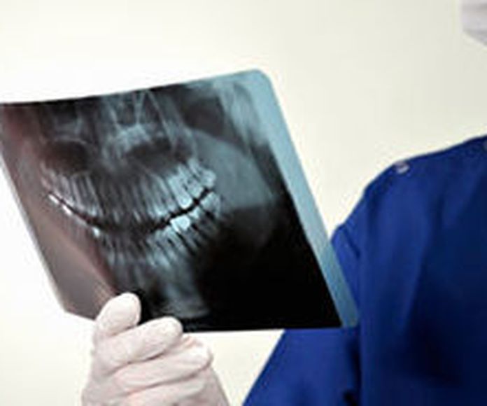 Cirugía oral: Servicios que ofrecemos de Clínica Dental Dr. Delgado }}