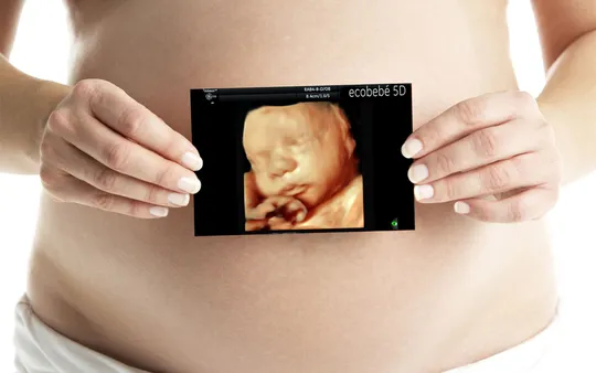 Imagen 5 de la galería