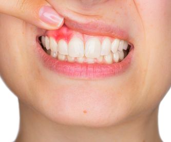 Odontología infantil: Tratamientos de Clínica Dental Del Valle