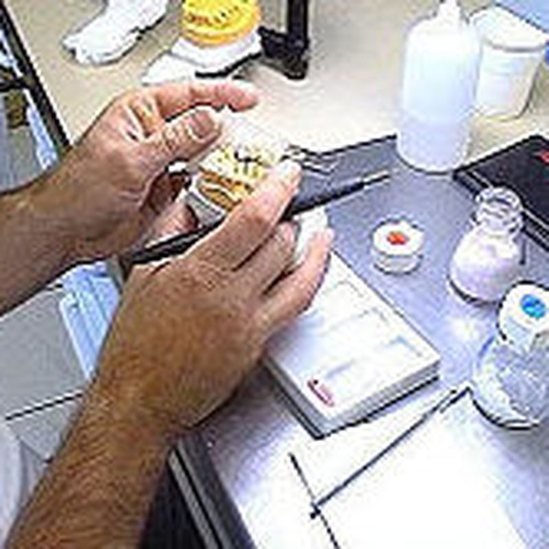 Prótesis fijas: Servicios de Ángel Dueñas Laboratorio Dental