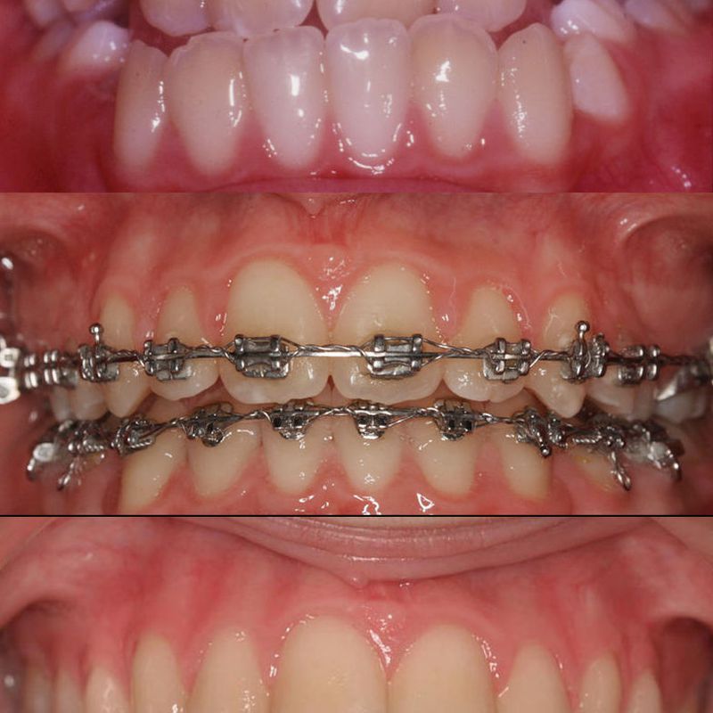 Ortodoncia para niños y adultos: Especialidades de Clínica Dental Castellbisbal