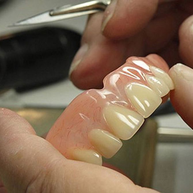 Consejos para el cuidado de la prótesis dental