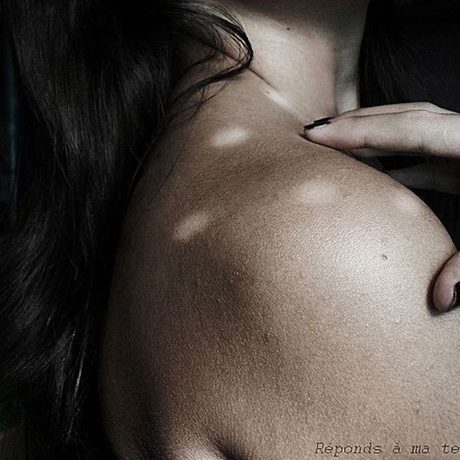 Primeros síntomas de la fibromialgia