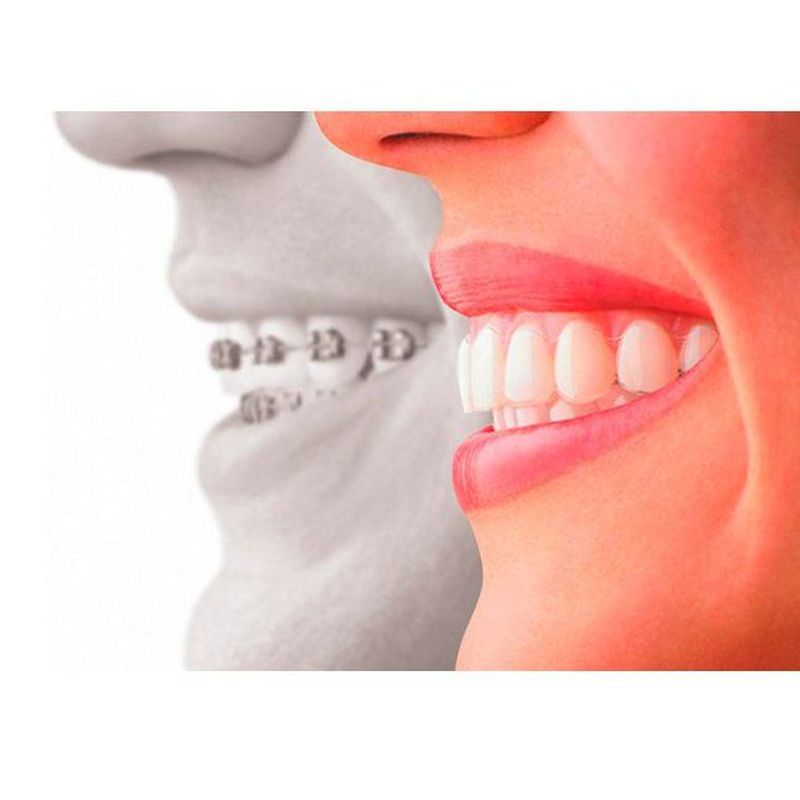Ortodoncia: Tratamientos dentales de Clínica Dental Dra. Clols