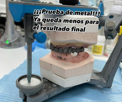 Prueba de metal