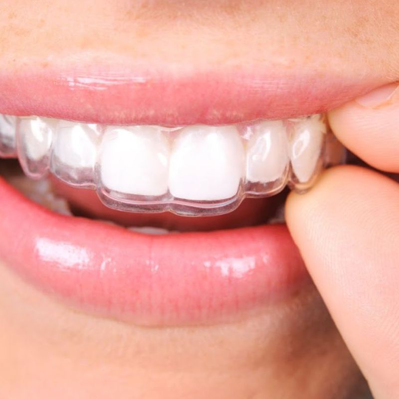 Ortodoncia: Tratamientos de Clínica Dental Dentimar
