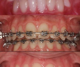 Odontología general : Especialidades de Clínica Dental Castellbisbal