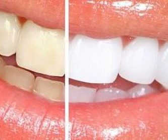 Ortodoncia: Aiara Centro Dental de Aiara Centro Dental
