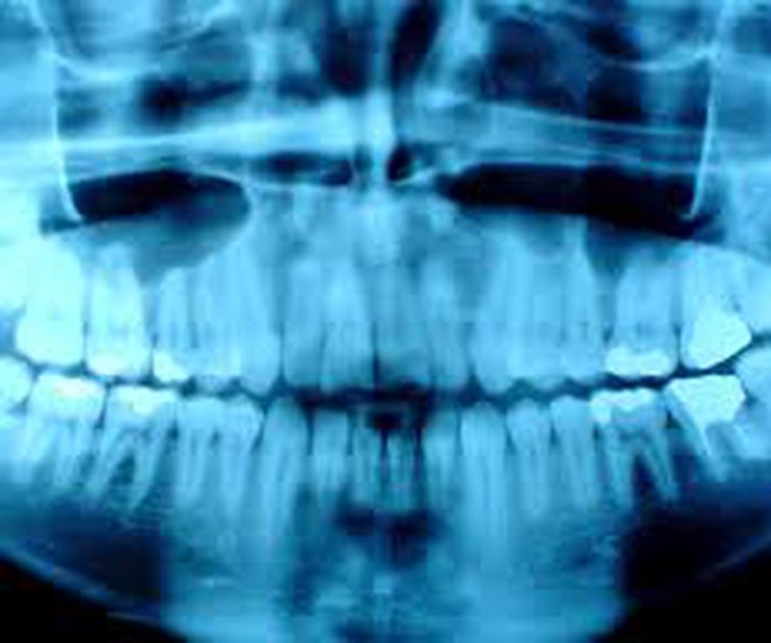 Radiografías: Tratamientos de Clínica Dental Fortaña-Giménez