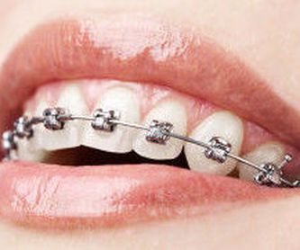 Estética dental: Tratamientos y tecnología de Clínica Dental Daniel Molina