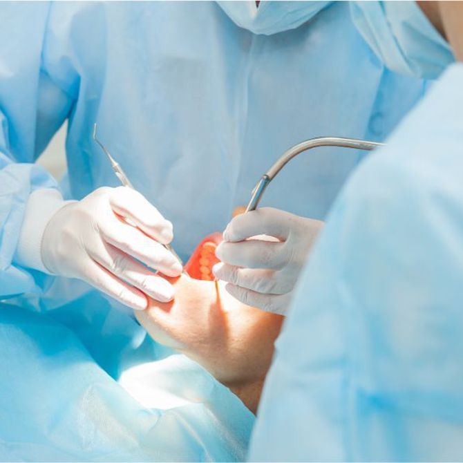 ¿Cuáles son las cirugías dentales más frecuentes?