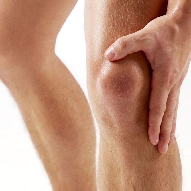 ¿Cómo se produce una luxación de rodilla?