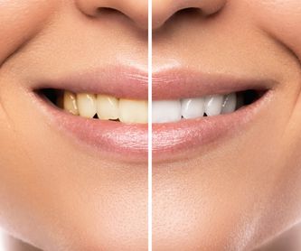 Ortodoncia: Catálogo de J&D Clínica Dental