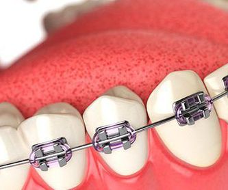 Especialistas en implantes dentales: Servicios de Clínica Sasermed Dental Buhaira