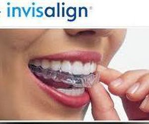 Invisaling, Ortodoncia invisible 