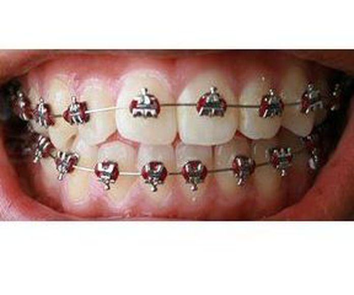 Ortodoncia: Tratamientos de Maribel Soto Vera - MS Dental