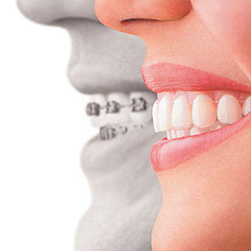 Ortodoncia: Nuestros servicios de Sant Hilari Centre odontològic